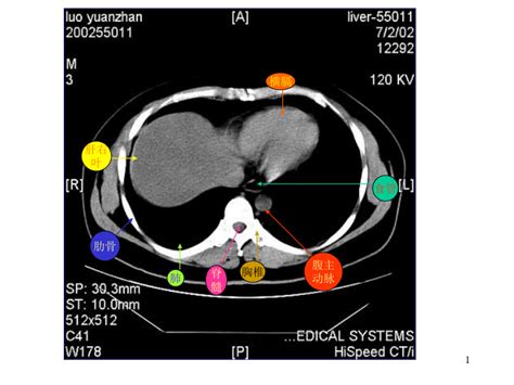 腹部ct断层解剖结构文档之家