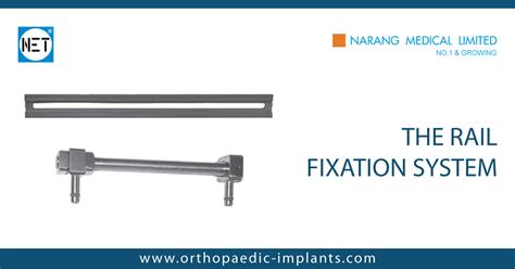 The Rail Fixation System The Rail Fixation System Manufacturer The