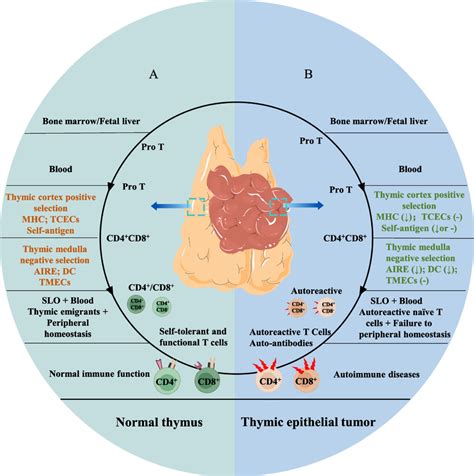 Naïve T cell development in the normal thymus and thymoma A A healthy