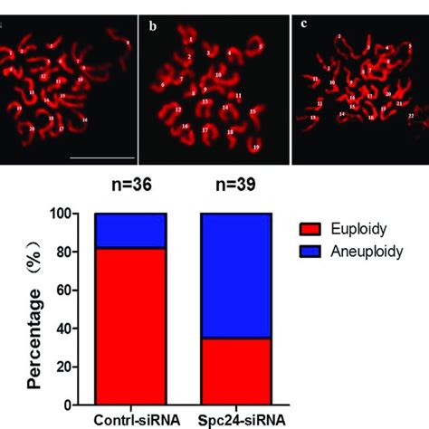 Subcellular Localization Of Spc During Mouse Oocyte Meiotic