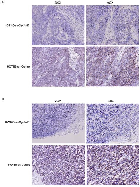 Representative Immunohistochemical Staining Of E Cadherin In Xenograft