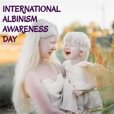 Copy Of International Albinism Awareness Day Postermywall