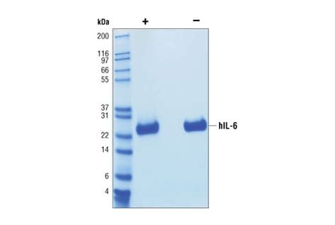 Human Interleukin 6 Hil 6 Cell Signaling Technology