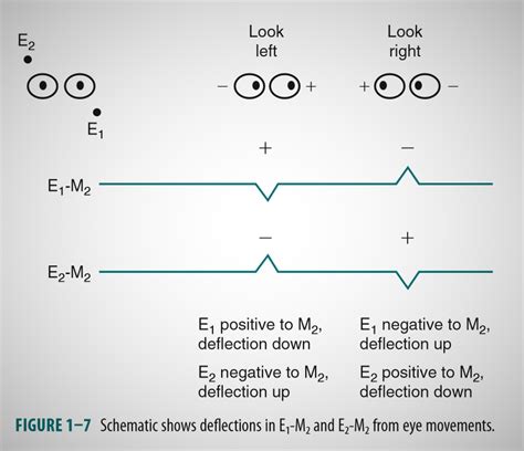 The Software: EOG Eye Movement Detection Overview | Details | Hackaday.io