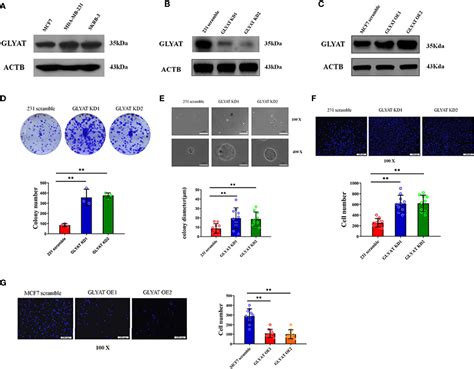 Frontiers Corrigendum Downregulation Of Glyat Facilitates Tumor