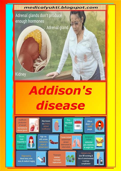 Addison S Disease Medical Yukti