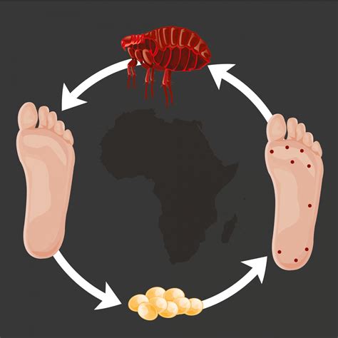 Sand Flea Bites on Humans - Pictures, Treatment and Prevention - FLEABITES