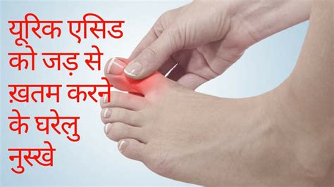 Uric Acid Ka Gharelu Ilaj Uric Acid Treatment Home Remedies Hindi Youtube