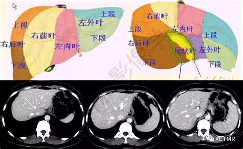 肝脏分叶分段的影像学解剖网络