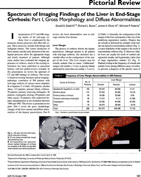 Spectrum Of Imaging Findings Of The Liver In End Stage Cirrhosis Part