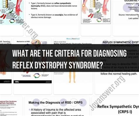 Diagnosing Reflex Dystrophy Syndrome Key Criteria JoyAnswer Org