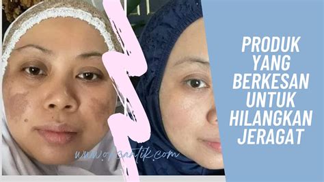 Produk Untuk Hilangkan Jeragat Yang Sangat Berkesan Ohcantik