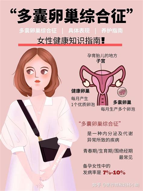 女性健康知识！多囊卵巢养护指南 知乎