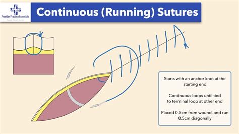 Running Locking Stitch