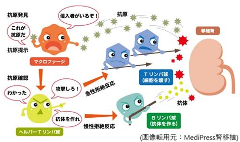 【腎移植のリアル】手術終わって万々歳！！とはならない。美談の陰に隠れた生体腎移植「暗」の部分 腎生を善く生きる~在宅血液透析患者のリアル~