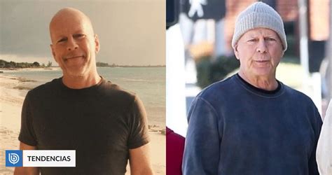 Publican Primeras Im Genes De Bruce Willis Tras Ser Diagnosticado Con