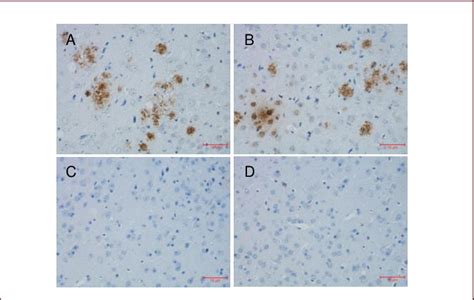 Induction Of Anti Amyloid Beta Aβ Antibodies Binding Aβ Plaques In