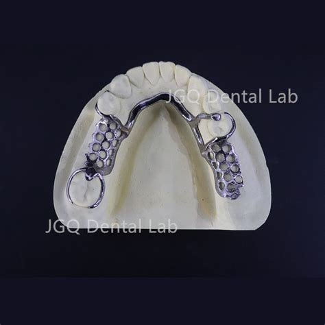 China Dental Lab Oem Hot Sale Milled Pure Titanium Partial Framework With Acrylic Dentures