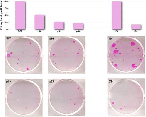 Colony Forming Efficiency Analysis Of Nhek Transduced With P14arf Download Scientific Diagram