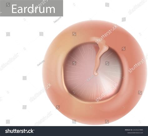 Anatomy Humans Eardrum Healthy Tympanic Membrane Stok Vektör Telifsiz 2115117995 Shutterstock