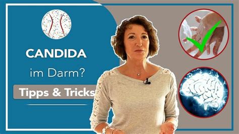 A Woman Standing In Front Of A Blue Sign That Says Candida Im Dam Tips