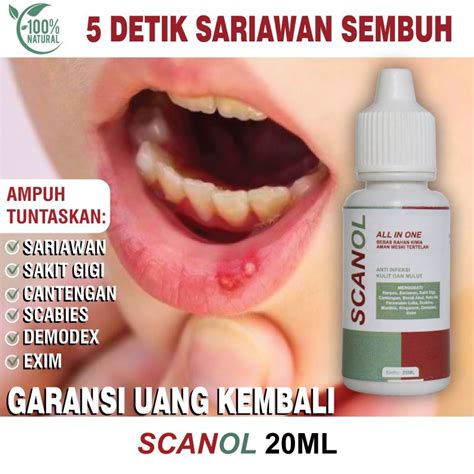 Jual Obat Tetes Sariawan Mulut Sariawan Bayi Dewasa Sariawan Bibir