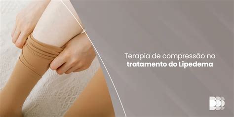 Lipedema Sintomas Diagn Stico E Op Es De Tratamento