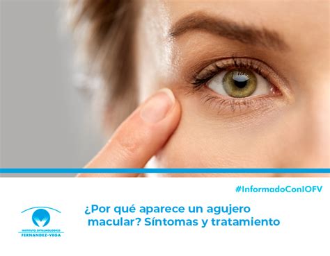 Por qué aparece un agujero macular Síntomas y tratamiento