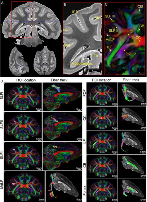 Representative Ex Vivo Mri Images Of Macaque Brain A Typical