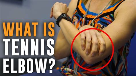 Injury Spotlight What Is Tennis Elbow Stretches And Exercises Youtube