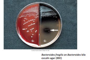 Microbiology Rotation Differential And Inhibitory Agars Flashcards