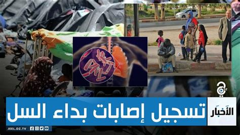 وزارة الداخلية تحذر من تسجيل إصابات بداء السل لدى الرعايا الأفارقة