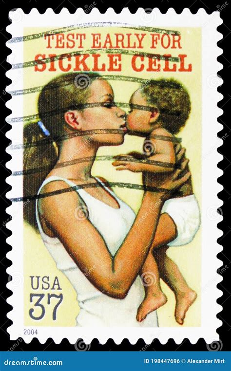 Postage Stamp Printed In United States Shows Sickle Cell Disease