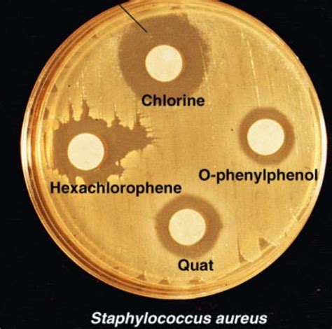 Chapter 7 Control Of Microbial Growth Flashcards Quizlet