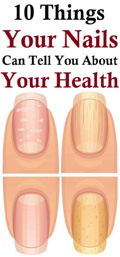 Things Your Nails Can Tell You About Your Health Health Told You So