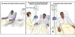 Trasplante Aut Geno De C Lulas Madre Stem Cell Transplant Autologous