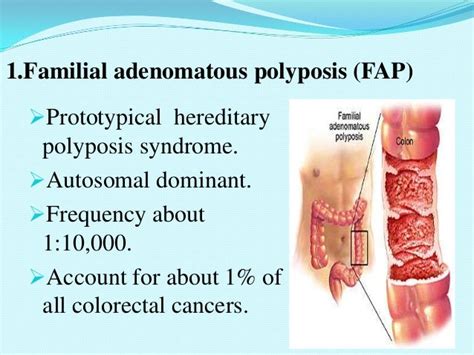 Polyposis Syndromes