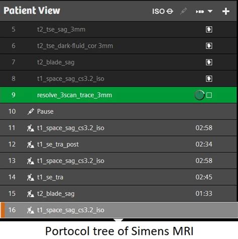 The Imperative of Selecting Optimal MRI Protocols for Optic Nerve Glioma Imaging » Business to mark