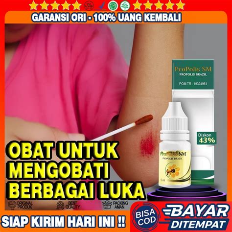 Jual Obat Mengatasi Berbagai Luka Obat Luka Basah Obat Luka Kering