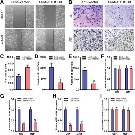 LncRNA PTCSC3 Overexpression Inhibits The Migration And Invasion Of U87