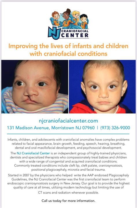 Improving Lives Of Children With Craniofacial Conditions