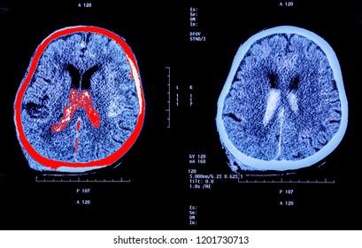 Medical Hospital Xray Hips Spine Pelvis Stock Photo