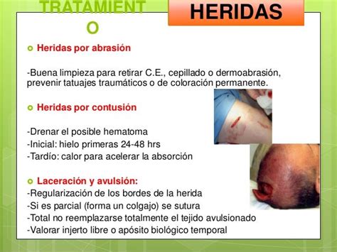 Heridas ClasificaciÓn De Heridas Y Su Manejo