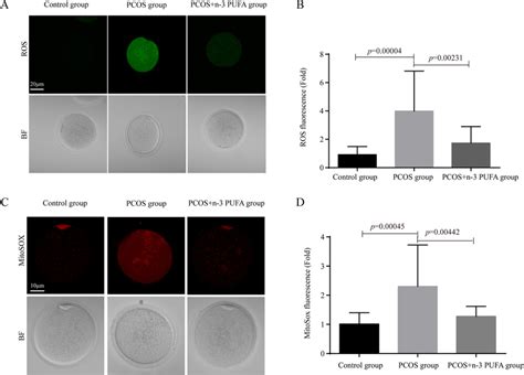 Effects Of N Pufas On Oxidative Stress In Pcos Mouse Oocytes