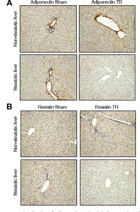 Figure 2 From Adiponectin And Resistin Protect Steatotic Livers