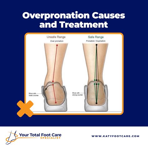 ankle pronation surgery