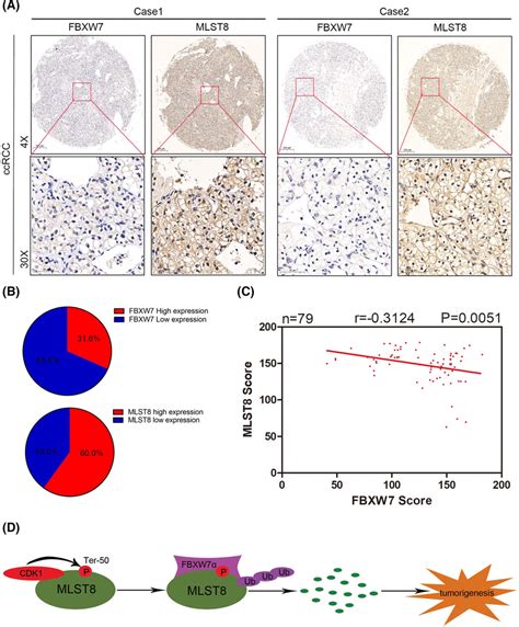 Mlst And Fbxw Protein Levels Negatively Correlate In Human Renal