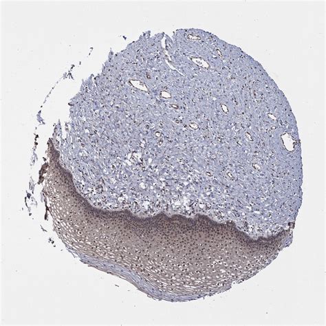 Tissue Expression Of Psmb6 Staining In Cervix The Human Protein Atlas