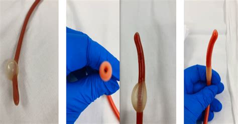 Council Tip Foley Catheter Vs Coude Foley Catheter Differences Uses