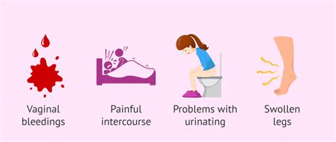 Clinical manifestations of cervical cancer